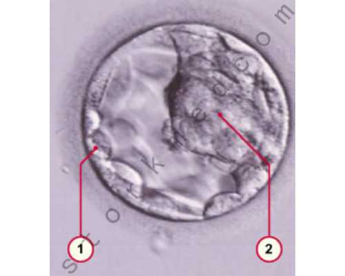 卵巢早衰能做泰国试管婴儿吗~捐卵公司
