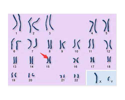 多囊卵巢来月经不正常可以做试管婴儿成功怀上浙江助孕吗