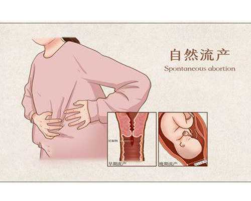 35岁大龄女人还能不能自然怀孕生孩子?