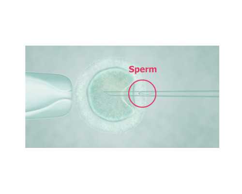 郑州供卵代怀条件,郑州供卵代怀包生男孩