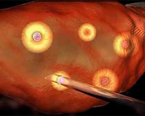 郑州借腹生子服务,郑州最好的试管是哪家医院好？靠谱服务机构万里挑一