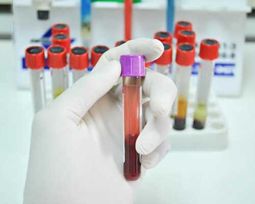 amh0.06还能做试管婴儿生育浙江助孕吗?