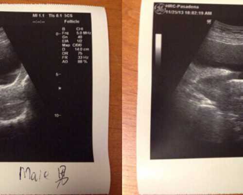 2026
郑州供卵助孕机构排名公布，附郑州最大的供卵机构详情_如何让窗帘变色