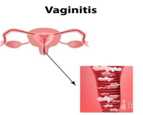 浙江助孕绿便怎么改善,浙江助孕腹泻该怎么喂养