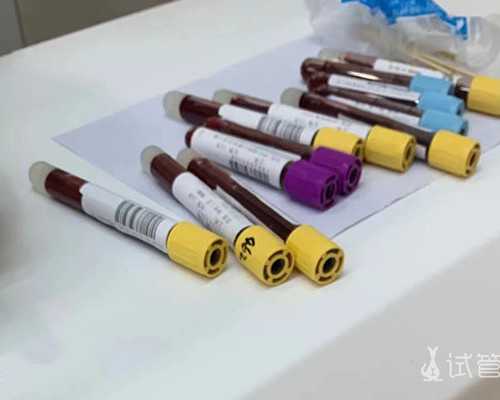 哪里医院做输卵管造影~供卵代怀收费