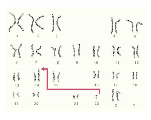 浙江助孕绿便怎么改善,浙江助孕腹泻该怎么喂养