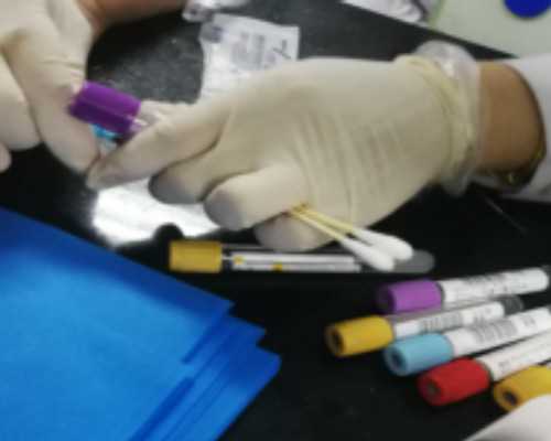 10条备孕注意事项教你怎样生一个健康浙江助孕