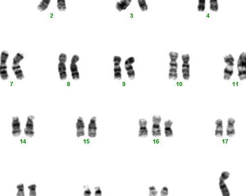 郑州做供精试管婴儿需要多少钱?,2026
郑州供精试管婴儿流程?-代怀孕靠谱吗