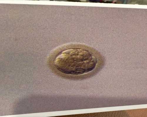 宜昌试管医院成功率排名?浙江试管成功率高的医院?