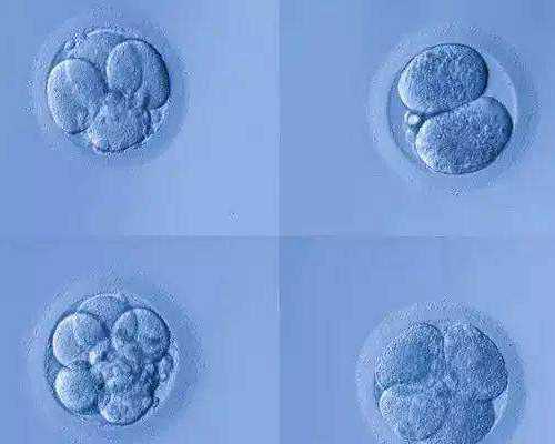 「如何看懂b超单」做b超如何看是女儿还是儿子