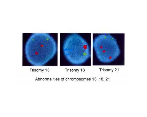 讲述柬埔寨试管婴儿真实经历,包成功说辞不可信!