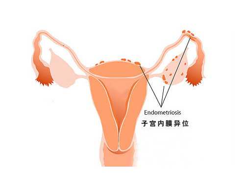 浙江助孕的浙江助孕的