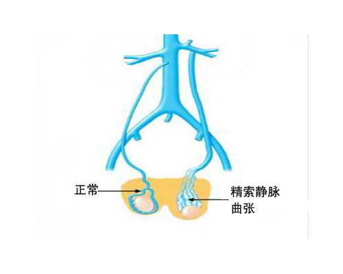 流感疫苗影响怀孕吗,打完流感疫苗怀孕了浙江助孕能要吗