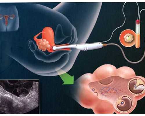 2026
郑州供卵助孕机构排名公布附郑州最大的供卵机构详情-医院可以供卵