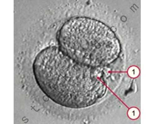 2026
郑州供卵助孕机构排名公布附郑州最大的供卵机构详情-正规医院代孕