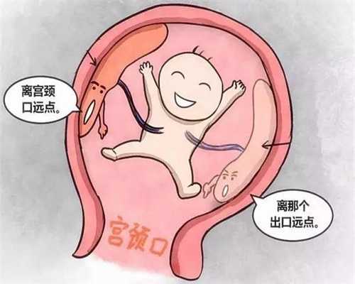 浙江有代孕的没有-代孕手术在哪里做_顺产后多久可以发汗